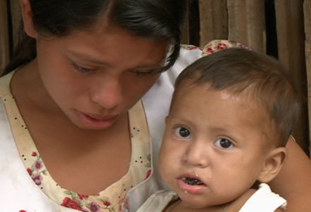 Fighting Malnutrition in Guatemala