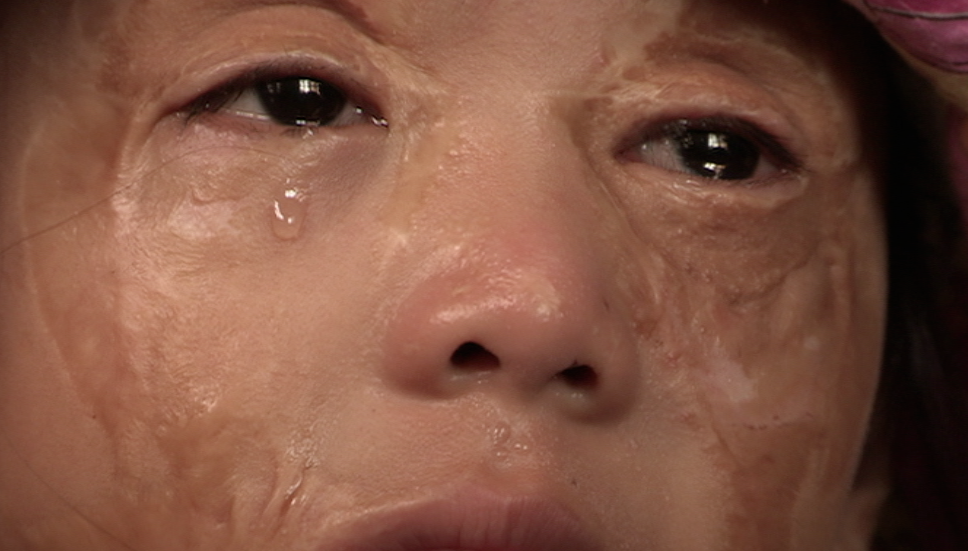 HI Acid Attacks Increasing SWPictures